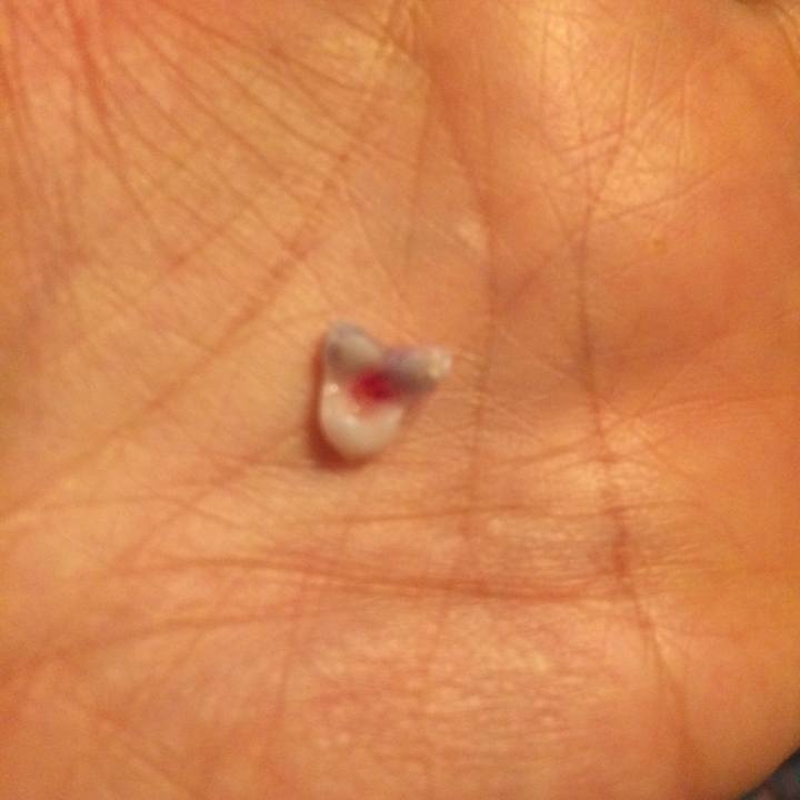 6bdb5246 de74 492b a487 a11c69b977aa 1511514017780