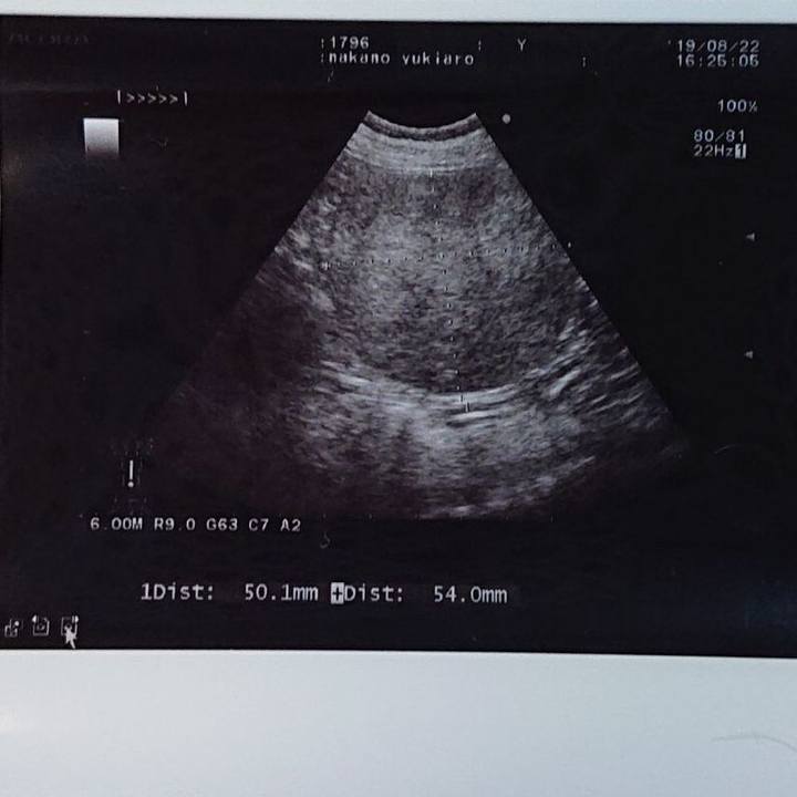 D4842ae2 63ca 443a 82e2 c6d5ba59b22b 1566613085071